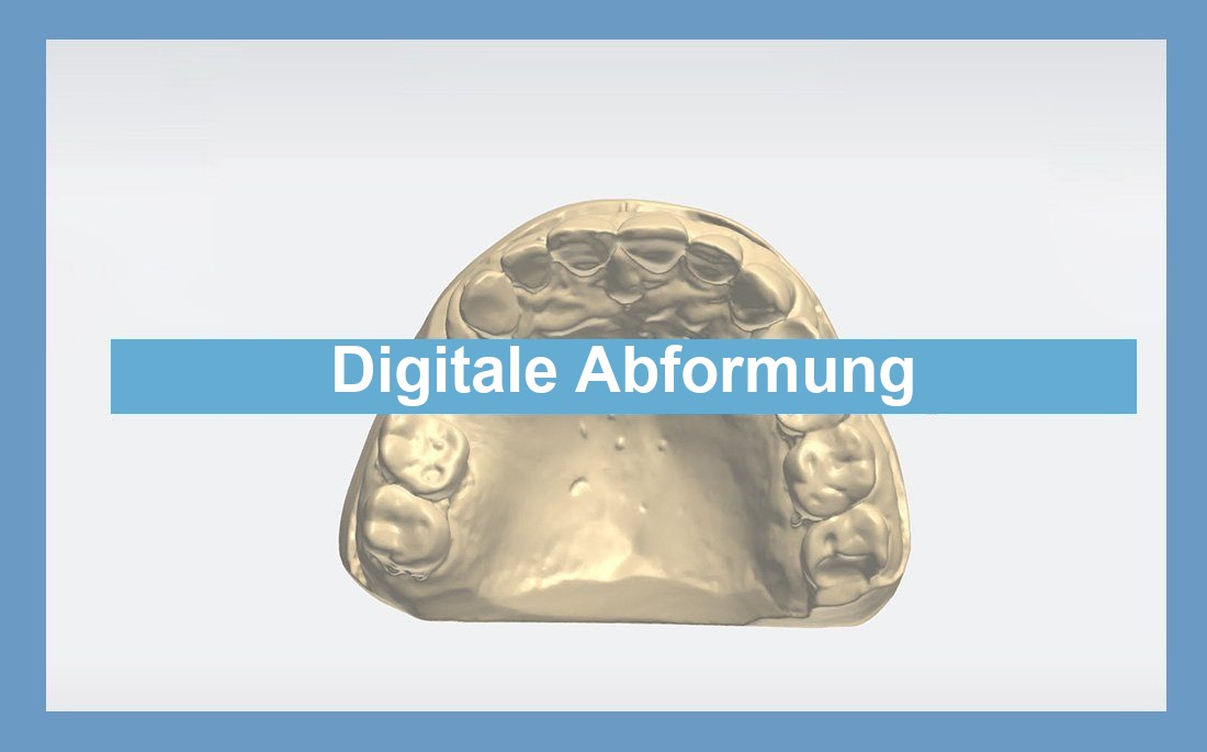 Illustration Artikel optische Abformung