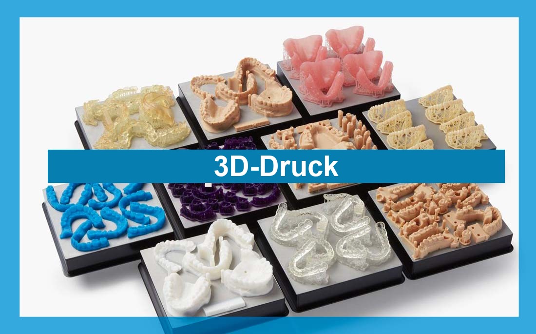 Illustration Artikel 3D-Druck in der Zahnheilkunde