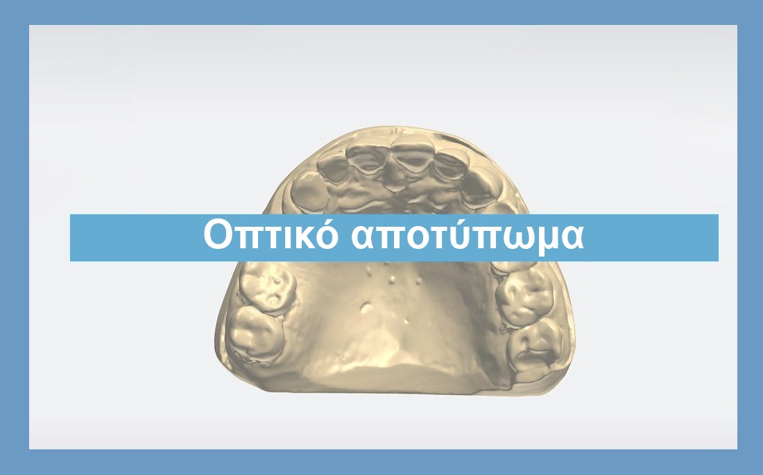 Απεικόνιση οπτικό αποτύπωμα