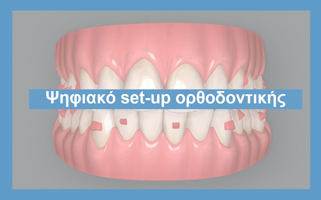 Απεικόνιση ψηφιακό set-up ortho