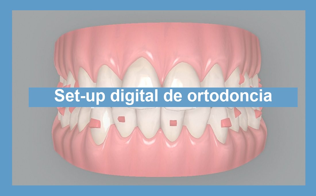 Ilustración artículo configuración digital en ortodoncia
