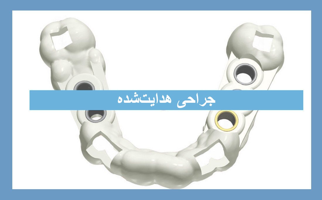 تصویر مقاله جراحی هدایت‌شده