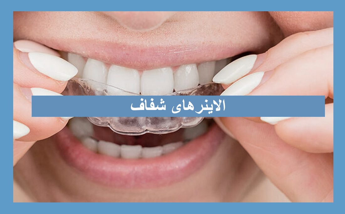 تصویر مقاله الاینرهای شفاف