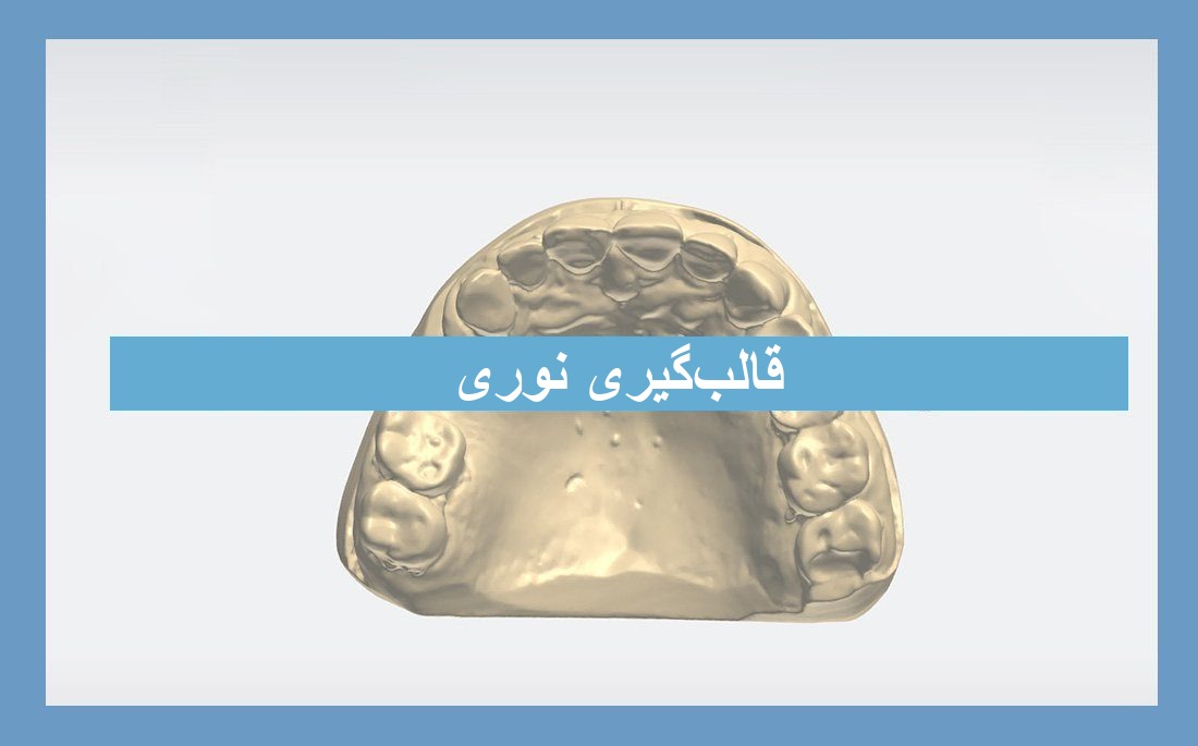 تصویر مقاله قالب‌گیری نوری دندان‌پزشکی