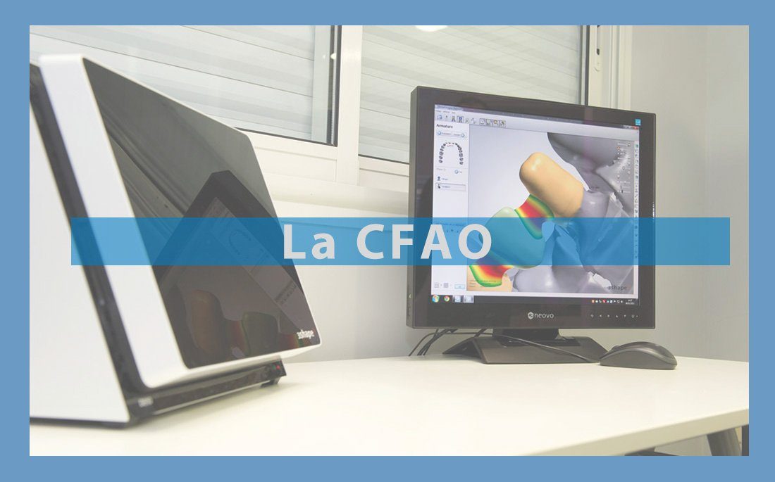 Illustration article CFAO