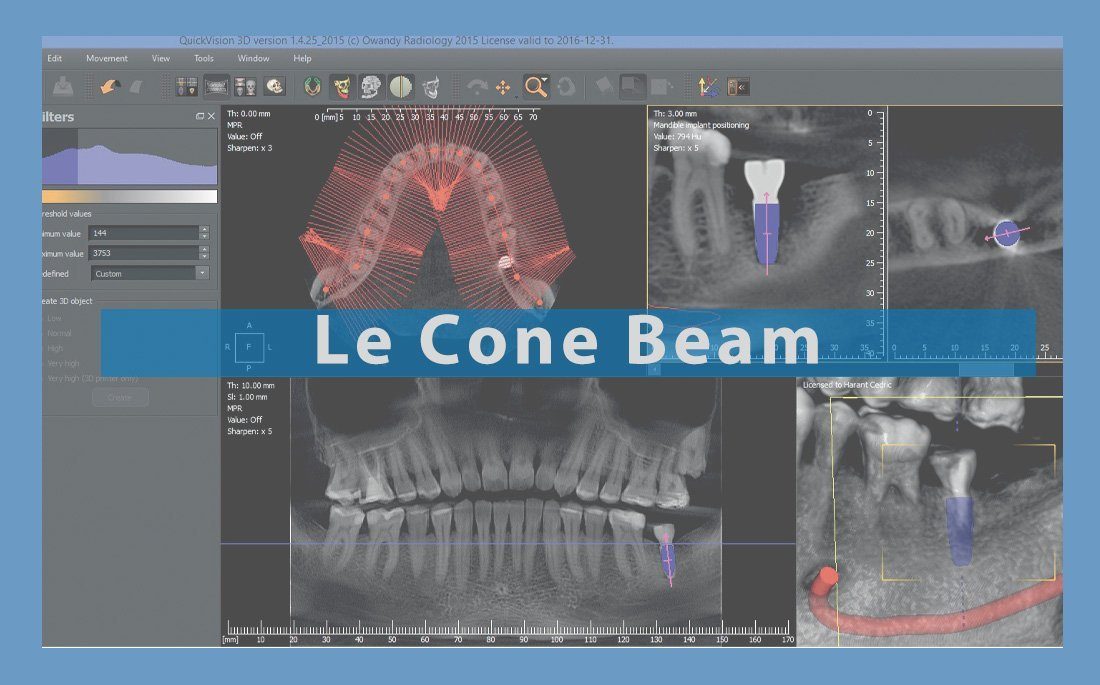 Illustration article le cone beam dentaire