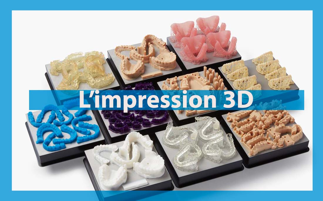 Illustration article l'impression 3D dentaire