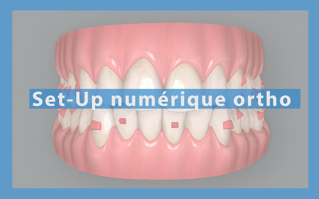 Illustration article set-up numérique ortho