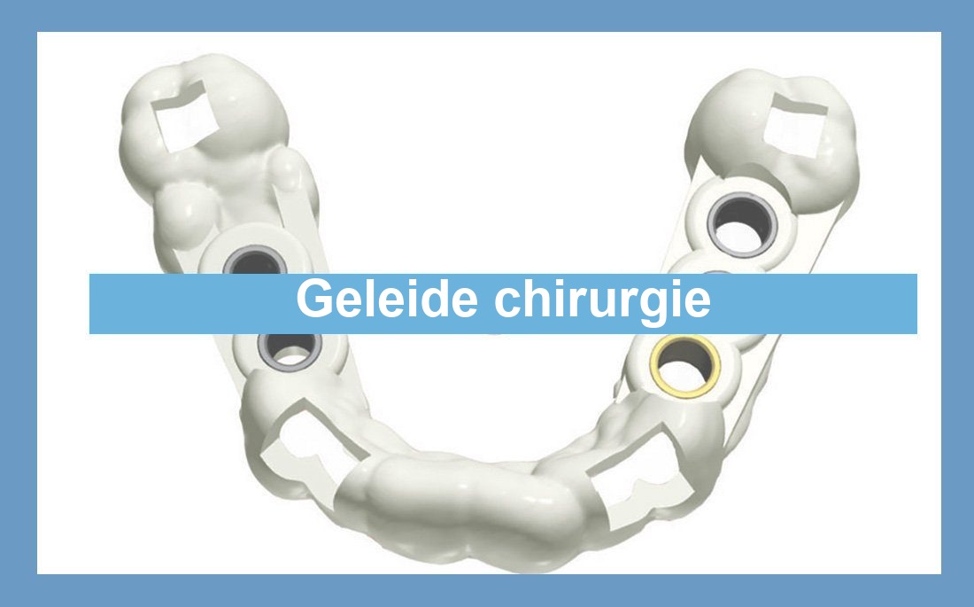 Illustratie geleide chirurgie