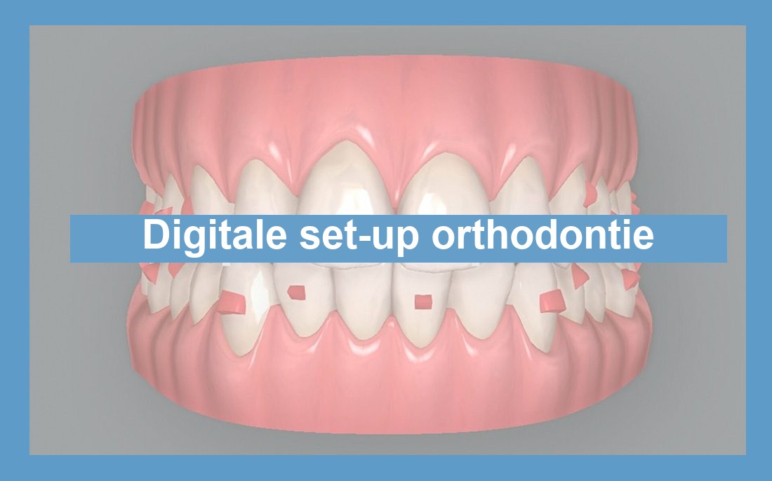 Illustratie digitale set-up orthodontie