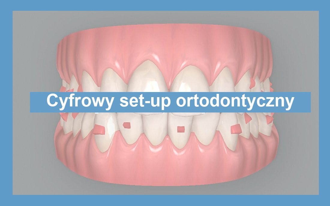 Ilustracja cyfrowy set-up w ortodoncji