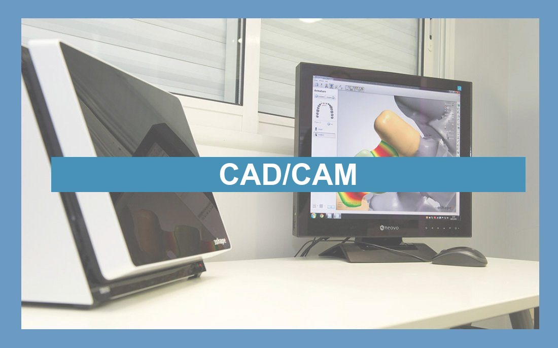 Ilustração artigo CAD/CAM