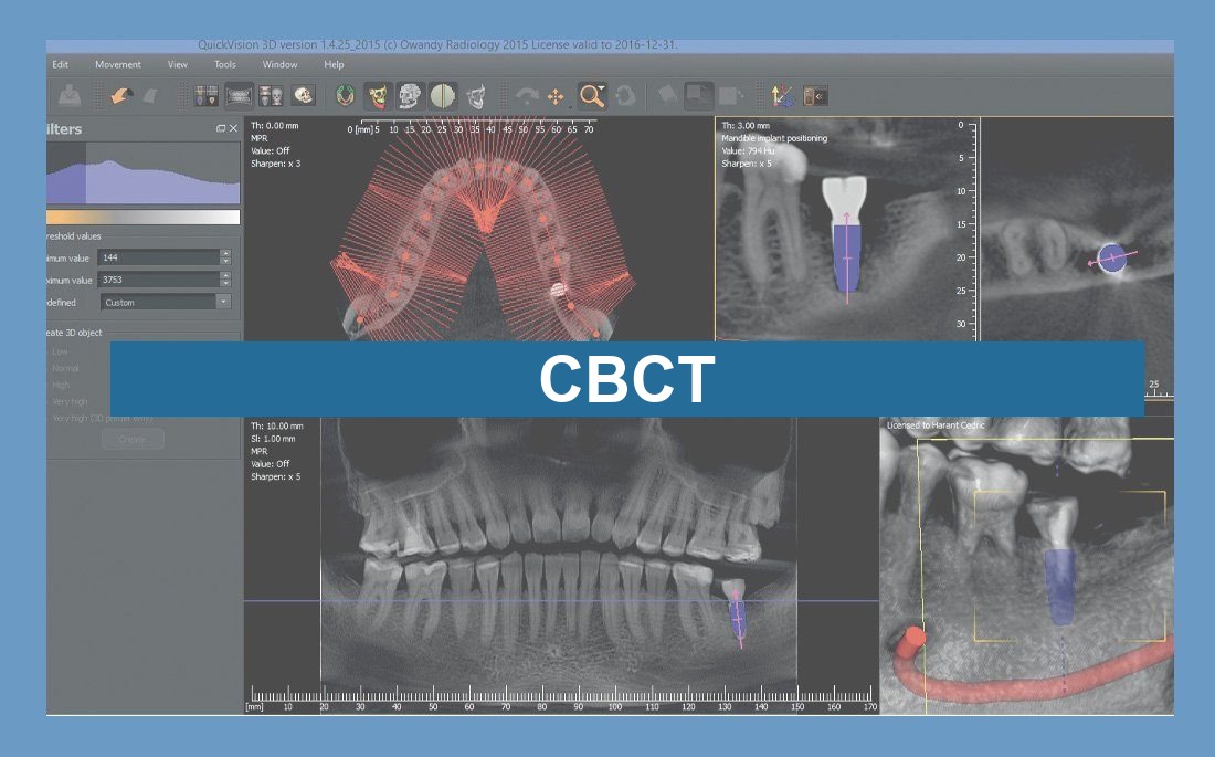 Ilustração artigo Cone Beam dental