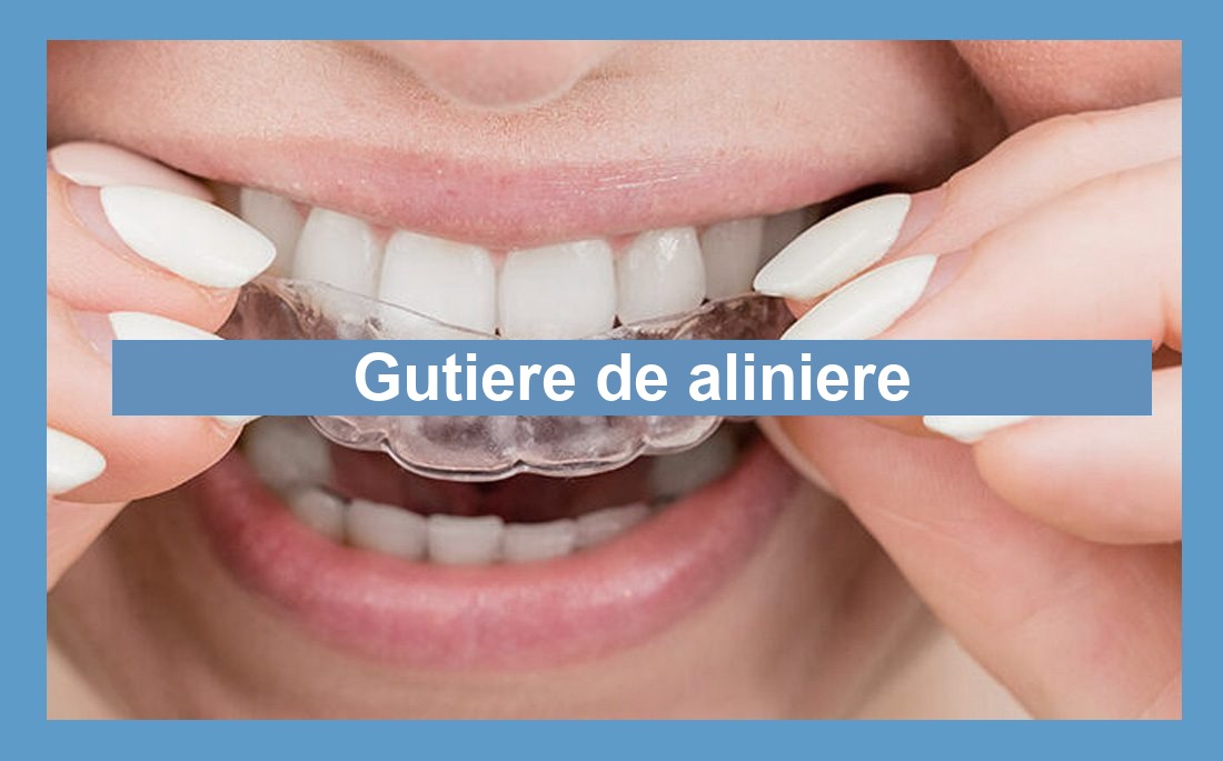 Ilustrație gutiere de aliniere