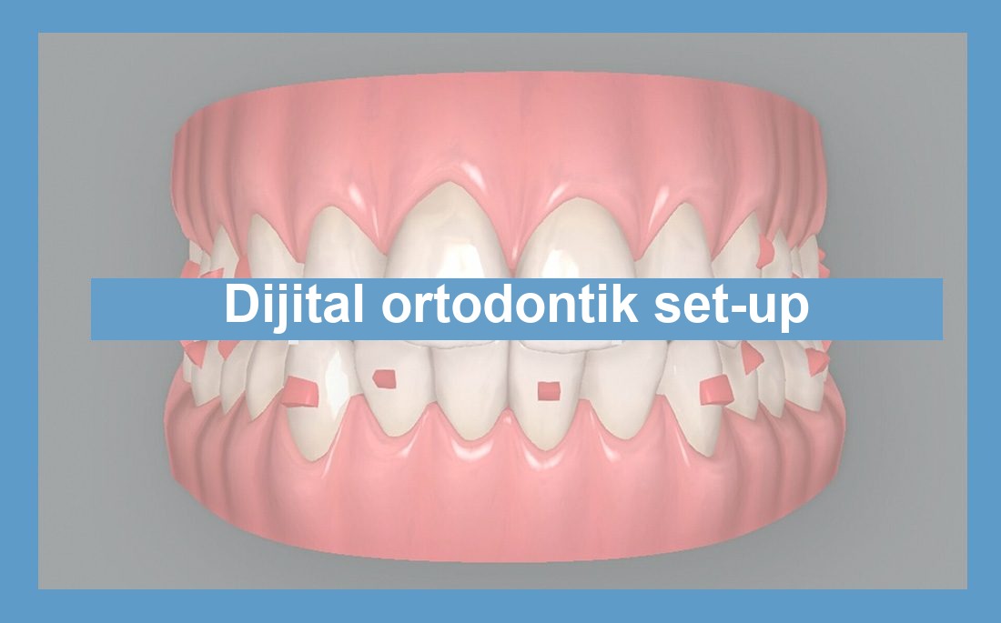 Ortodontide dijital set-up illüstrasyonu