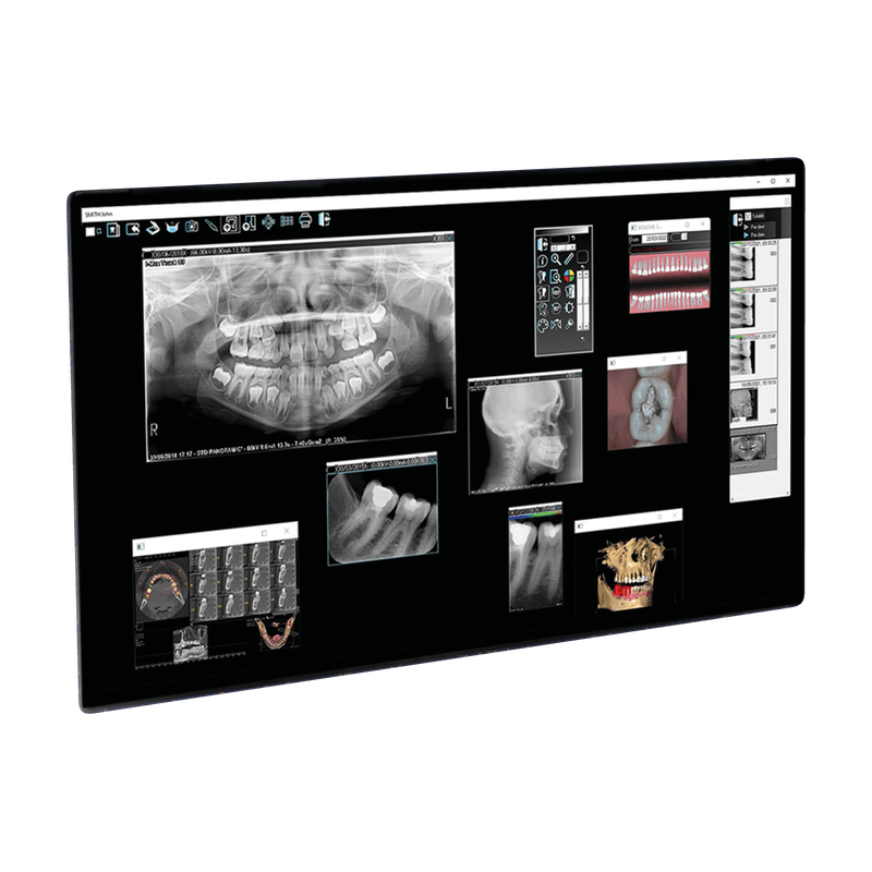QuickVision