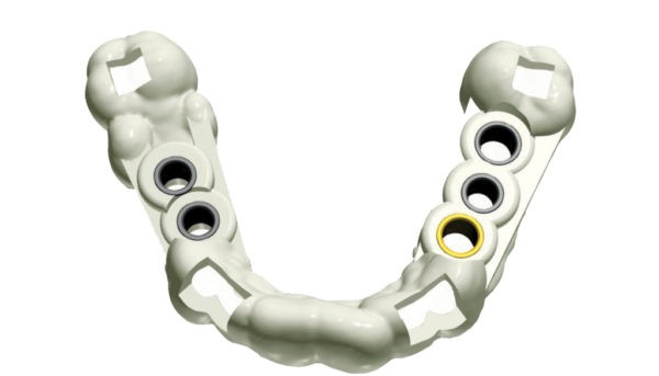 QuickVision 3D Création de guides chirurgicaux dentaire