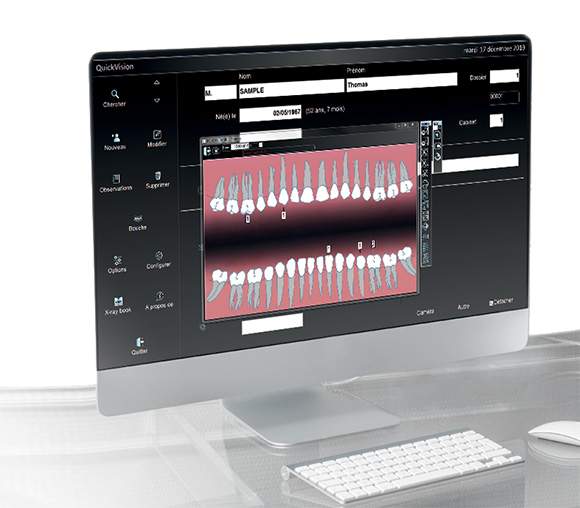 QuickVision logiciel de gestion pour cabinet dentaire