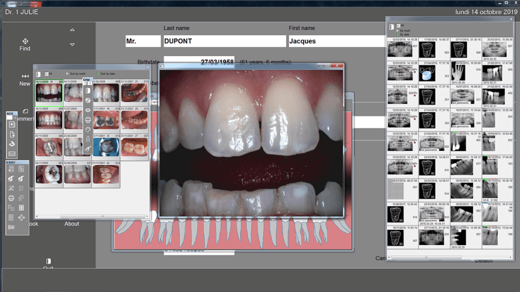QuickVision Logiciel de gestion pour cabinet dentaire - utilisation de caméra intraoral dentaire