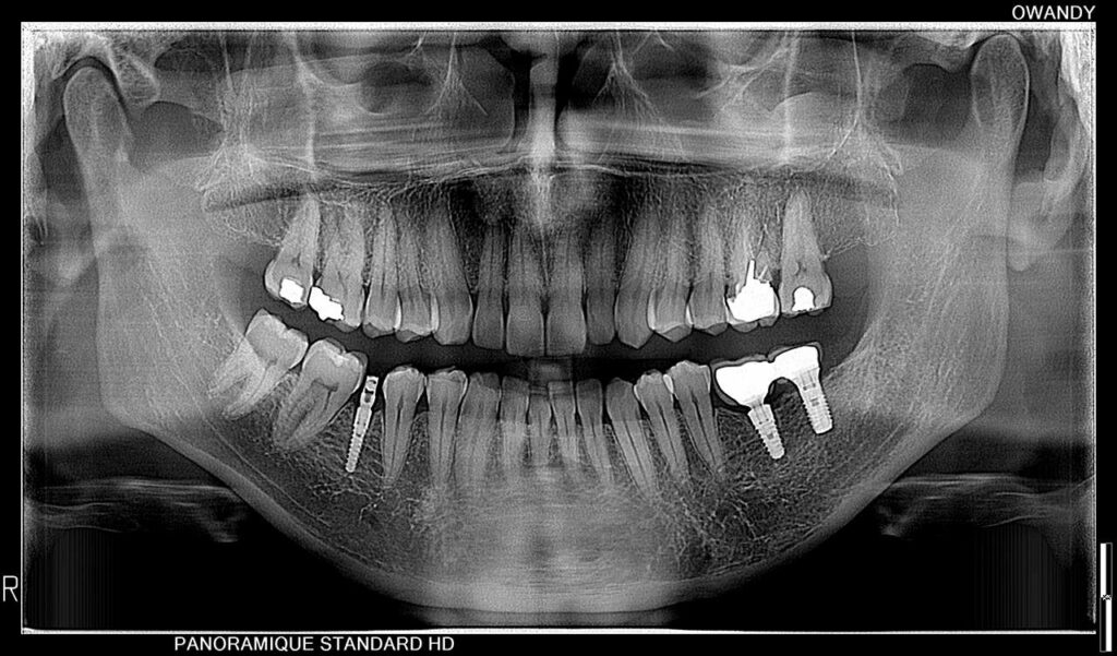 Dental panoramic