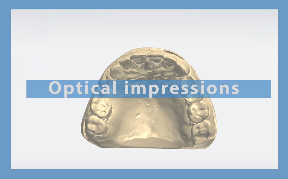 Optical impressions in odontology