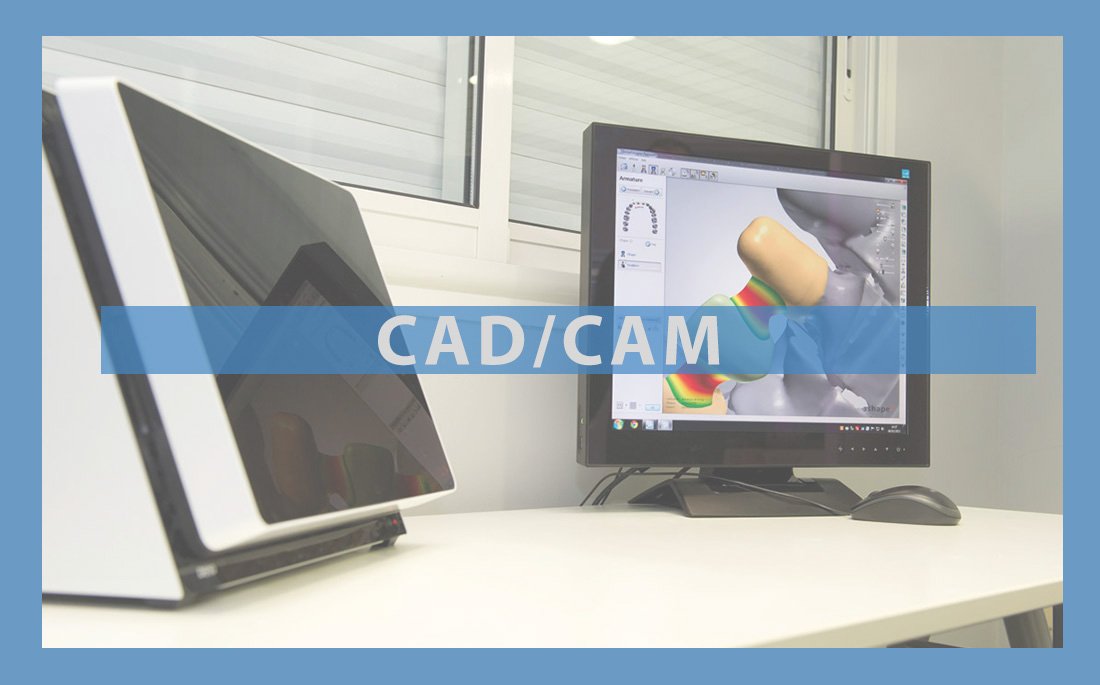 CAD/CAM in modern dentistry