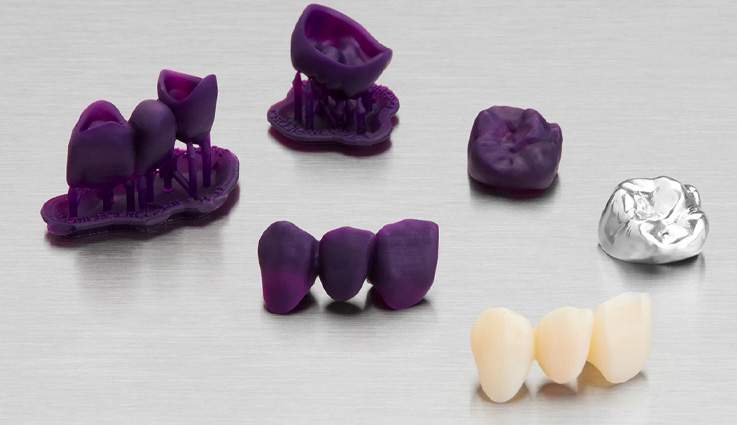 3d printing dental crowns